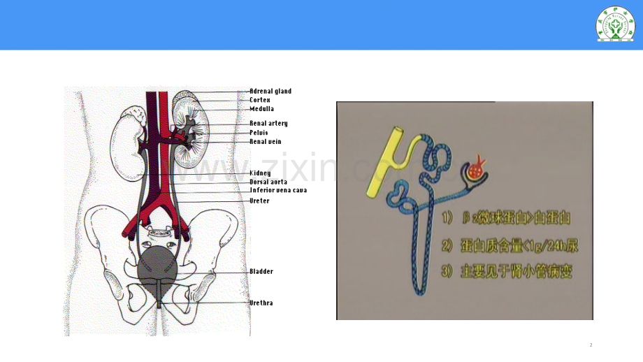 尿液检查.ppt_第2页