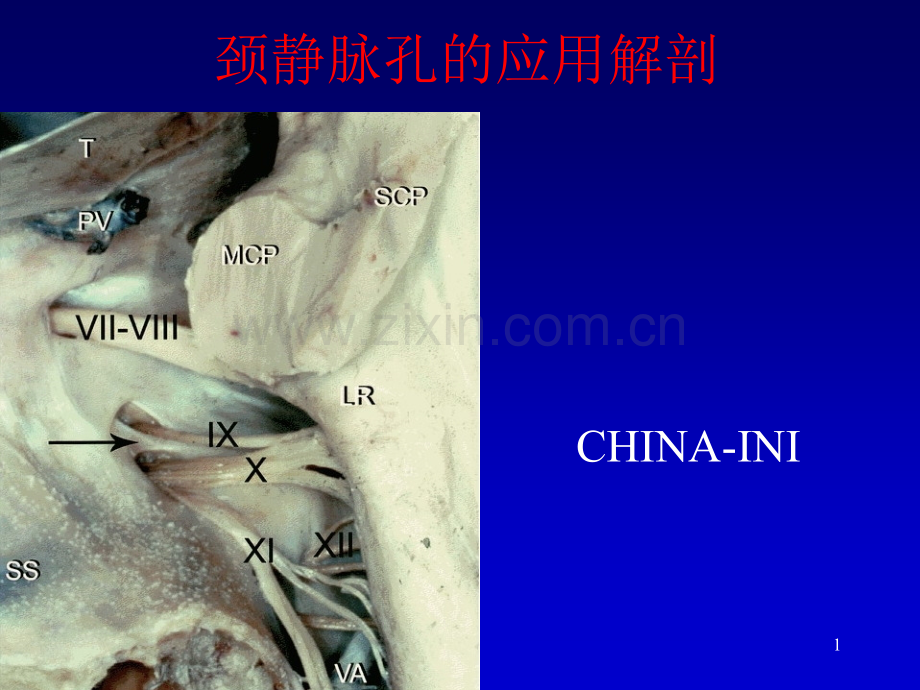 颈静脉孔区解剖.ppt_第1页
