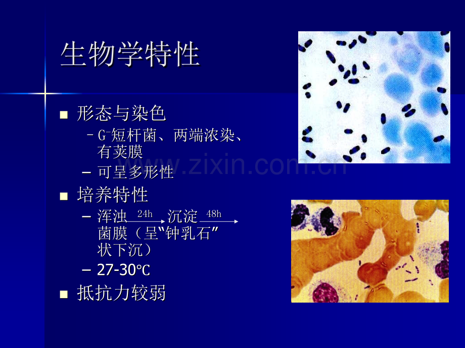 鼠疫的教案.ppt_第2页