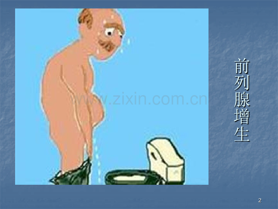 前列腺社区讲座.pptx_第2页