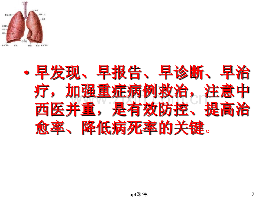 人感染H7N9治疗方案.ppt_第2页