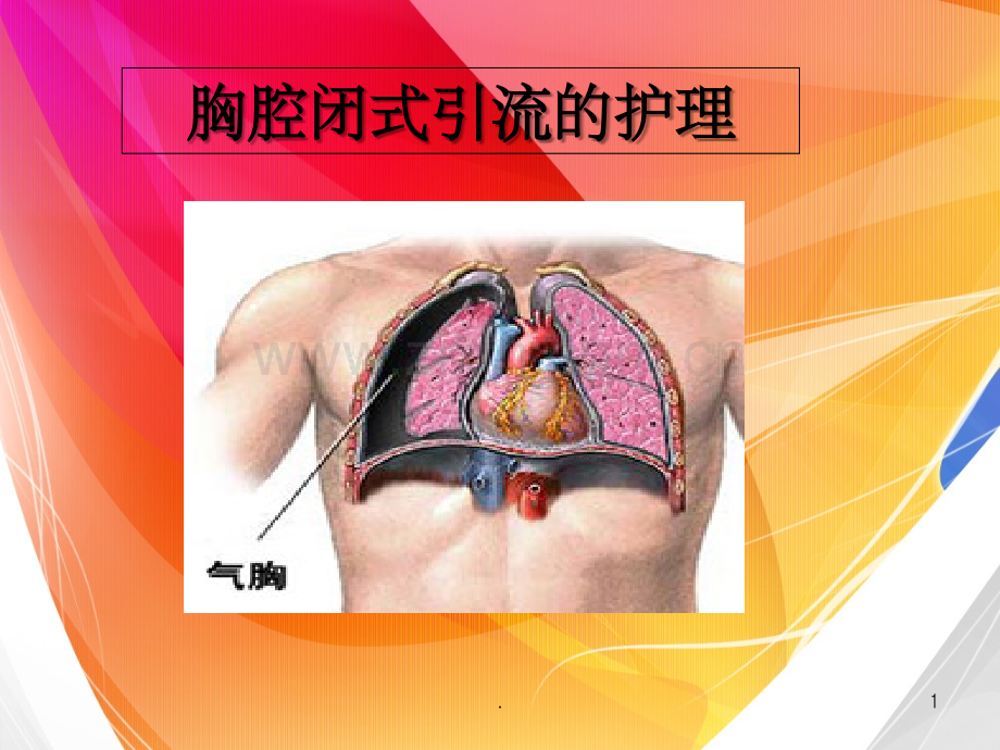 胸腔闭式引流的护理.ppt_第1页