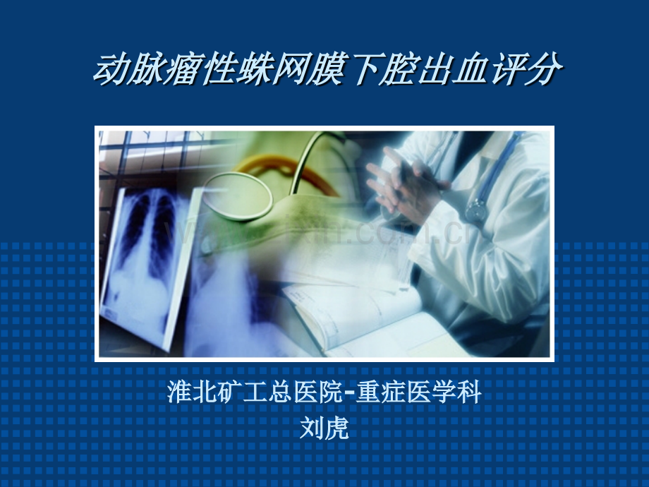 动脉瘤性蛛网膜下腔出血评分.ppt_第1页