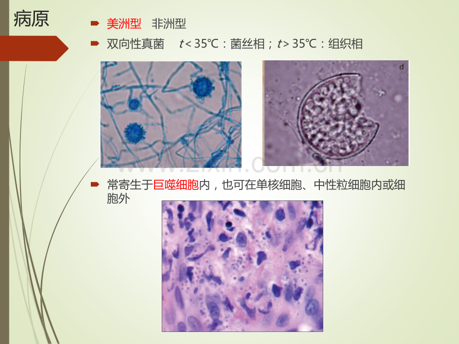 组织胞浆菌病.ppt_第2页