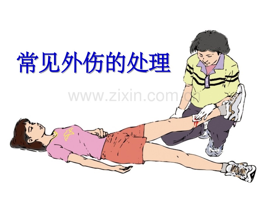 常见外伤的处理.ppt_第1页