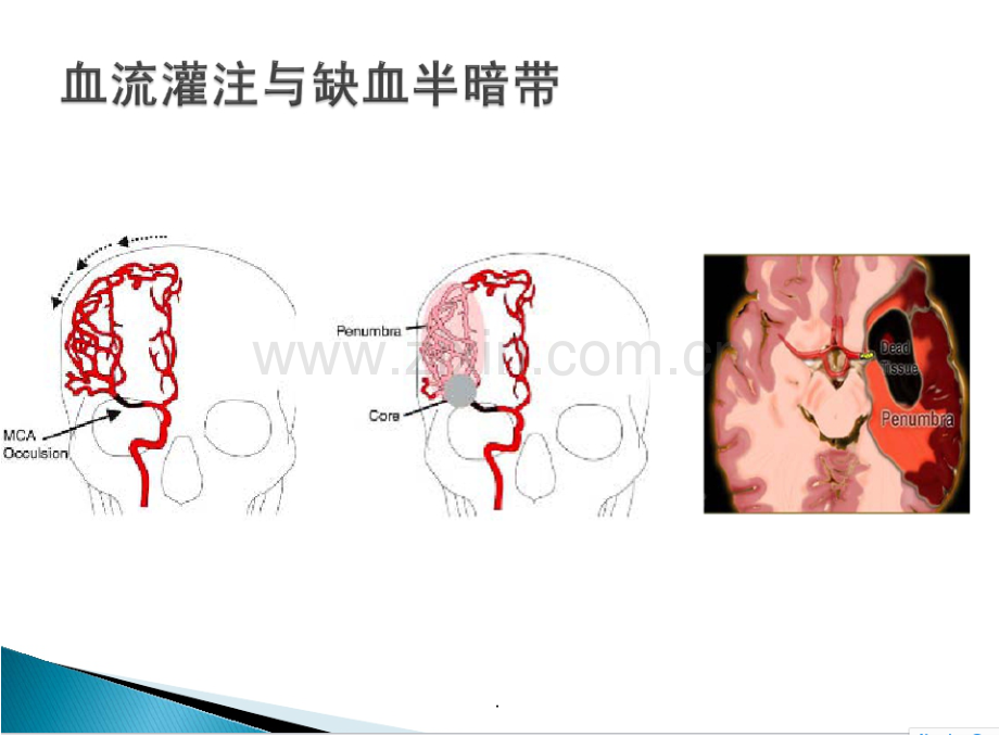 急性脑卒中绿色通道路径.ppt_第2页