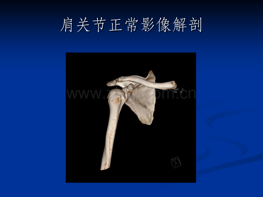 肩关节解剖及病变.ppt_第2页