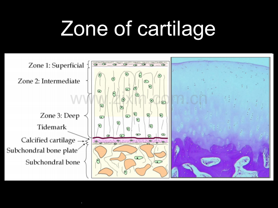 MRI-软骨损伤.ppt_第2页