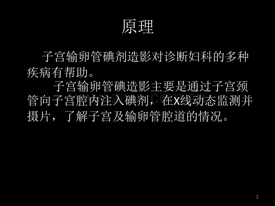 子宫输卵管造影及先天性发育异常.pptx_第2页