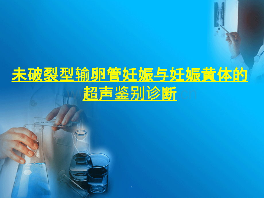 妊娠黄体与宫外孕的鉴别诊断.ppt_第1页