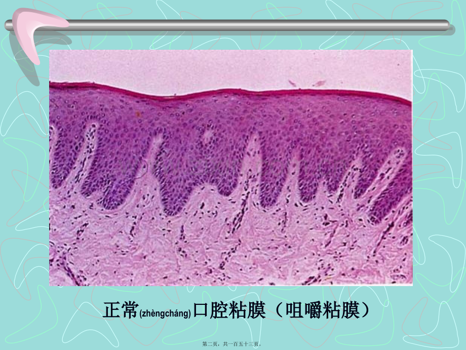 口腔粘膜病.ppt_第2页