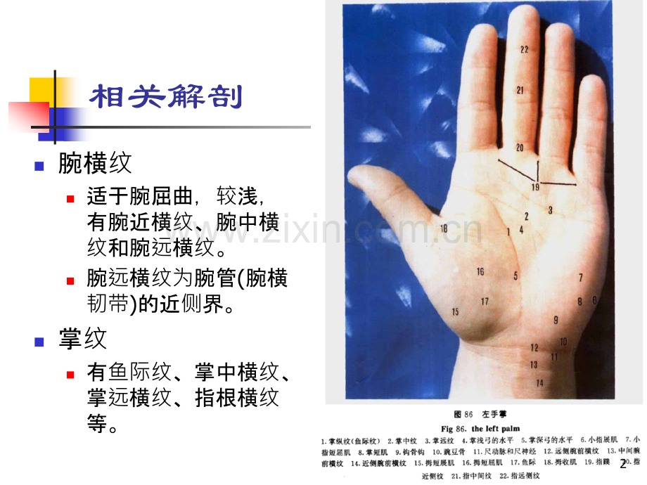 屈指肌狭窄性腱鞘炎.ppt_第2页