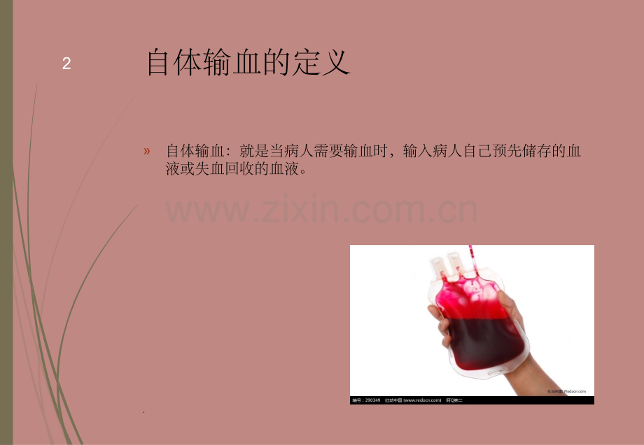 自体输血1.ppt_第2页