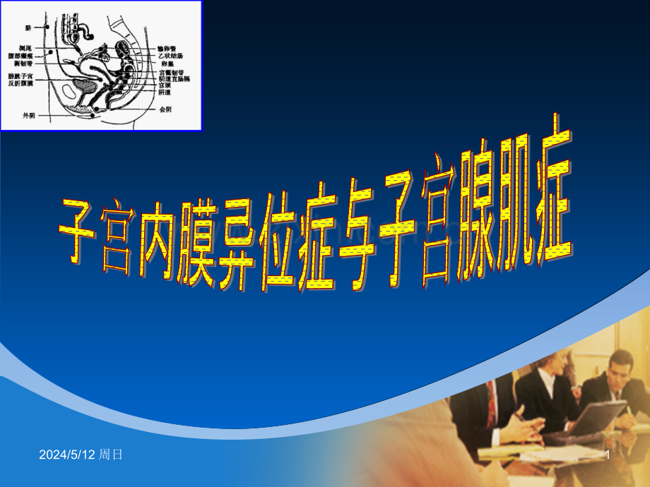 子宫内膜异位症和子宫腺肌病.ppt_第1页