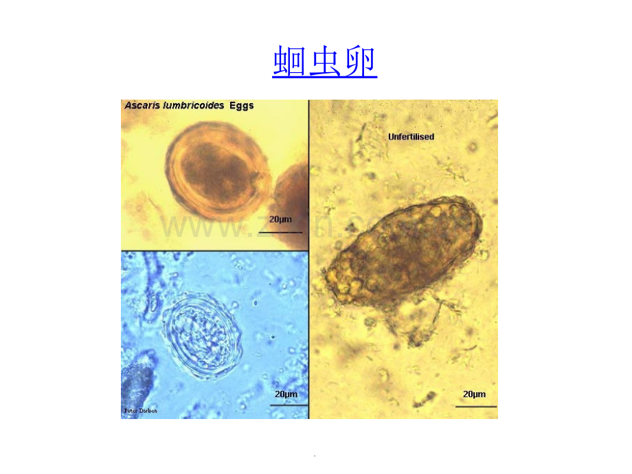 寄生虫学虫卵经典总结及图片.ppt_第2页