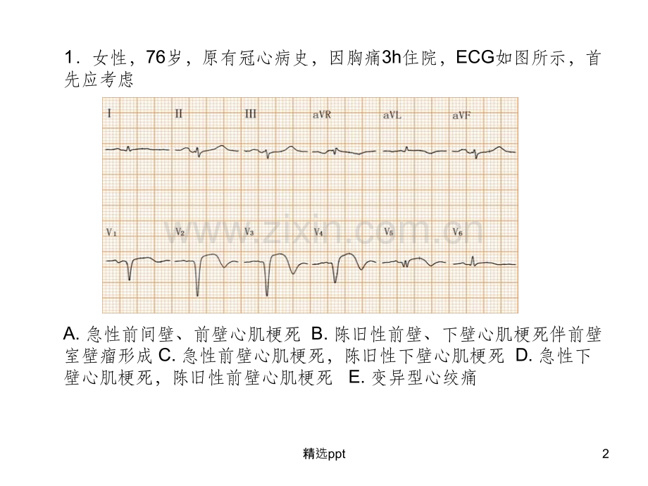 临床常见心电图试题.ppt_第2页