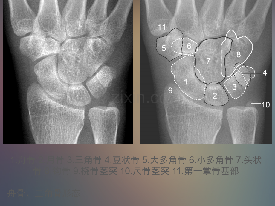 腕关节解剖.pptx_第2页