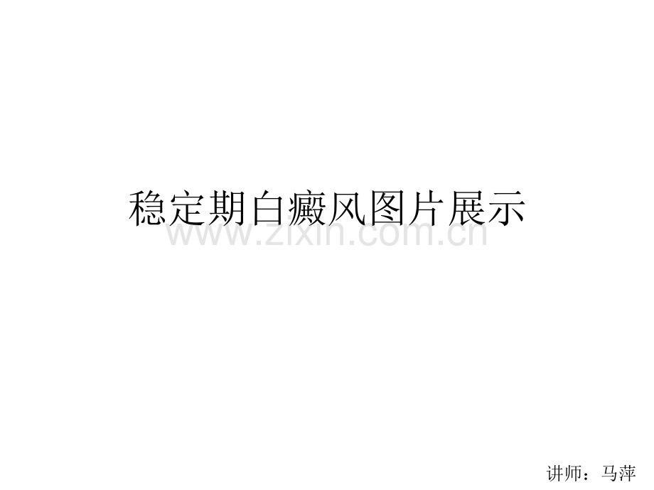 稳定期白癜风图片.pptx_第1页