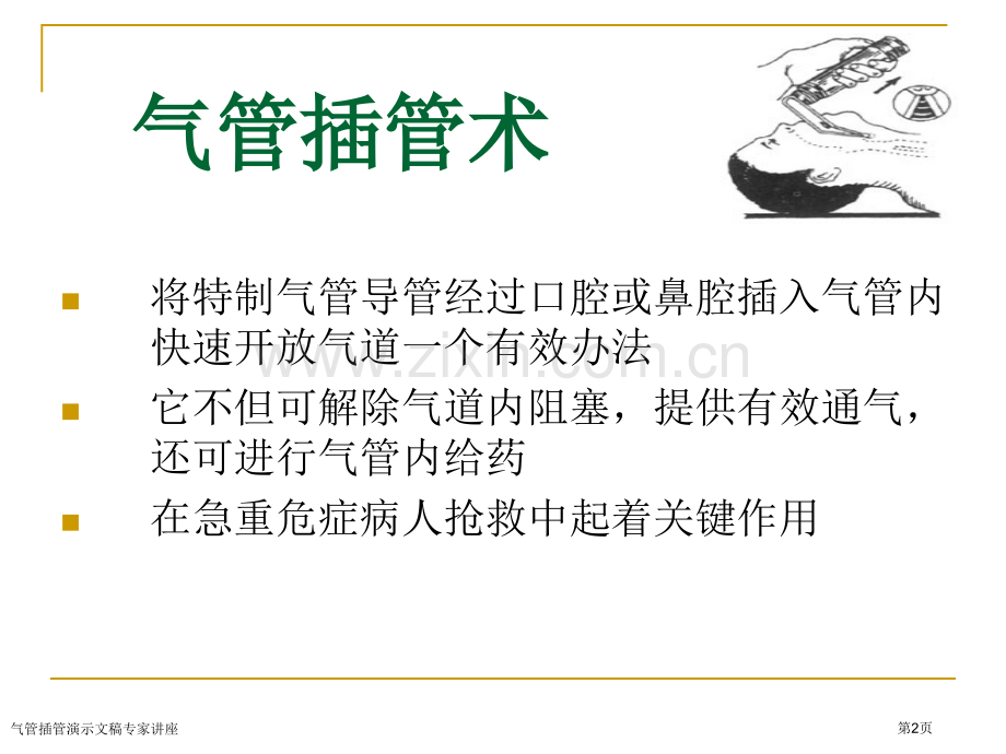 气管插管演示文稿专家讲座.pptx_第2页