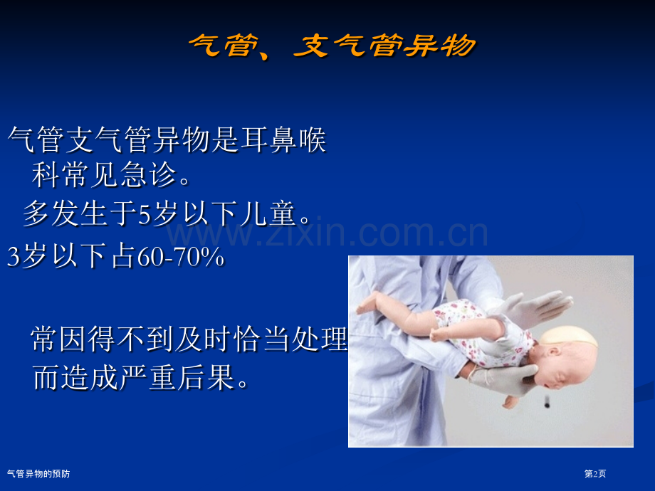 气管异物的预防.pptx_第2页