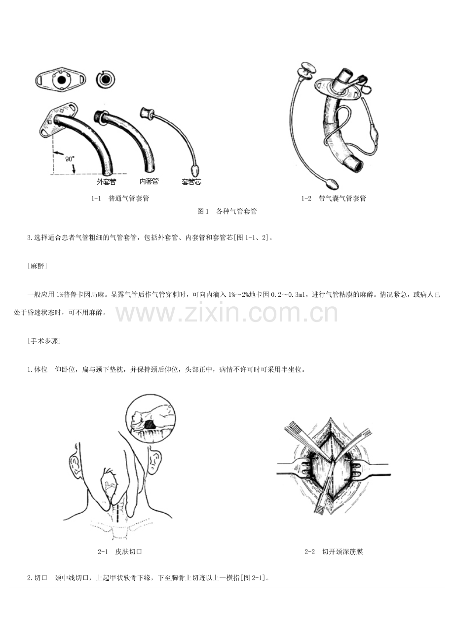 气管切开手术图解.doc_第2页