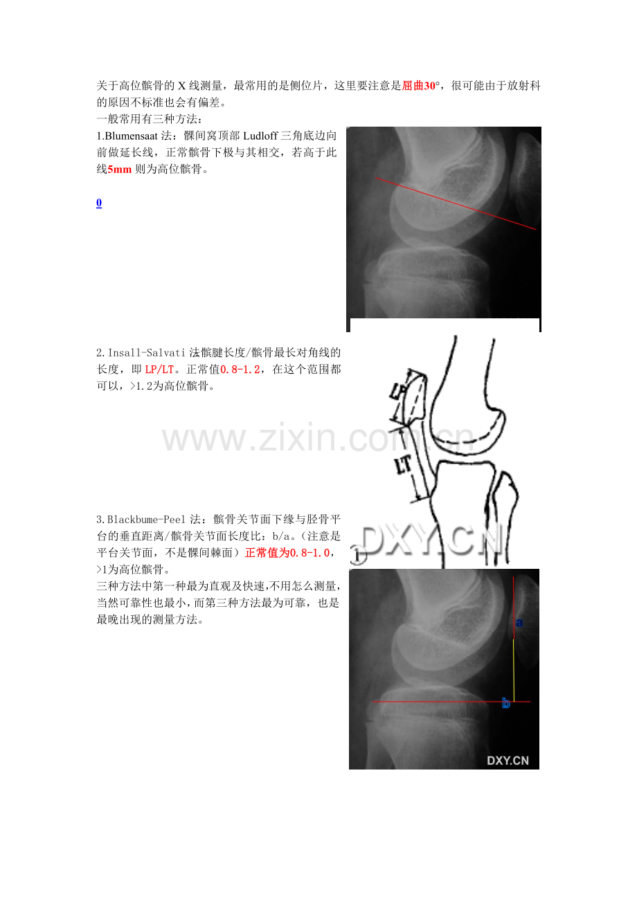 关于高位髌骨的X线测量及诊疗.doc_第1页