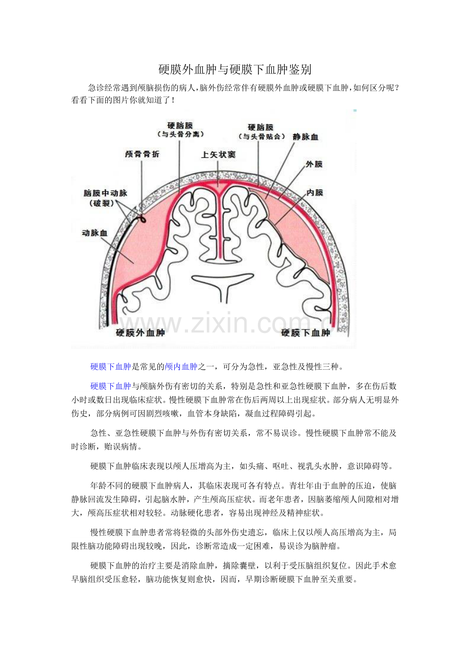 硬膜外血肿与硬膜下血肿鉴别.doc_第1页