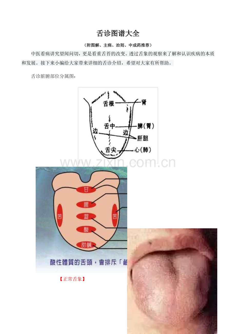 舌诊图谱大全.doc_第1页