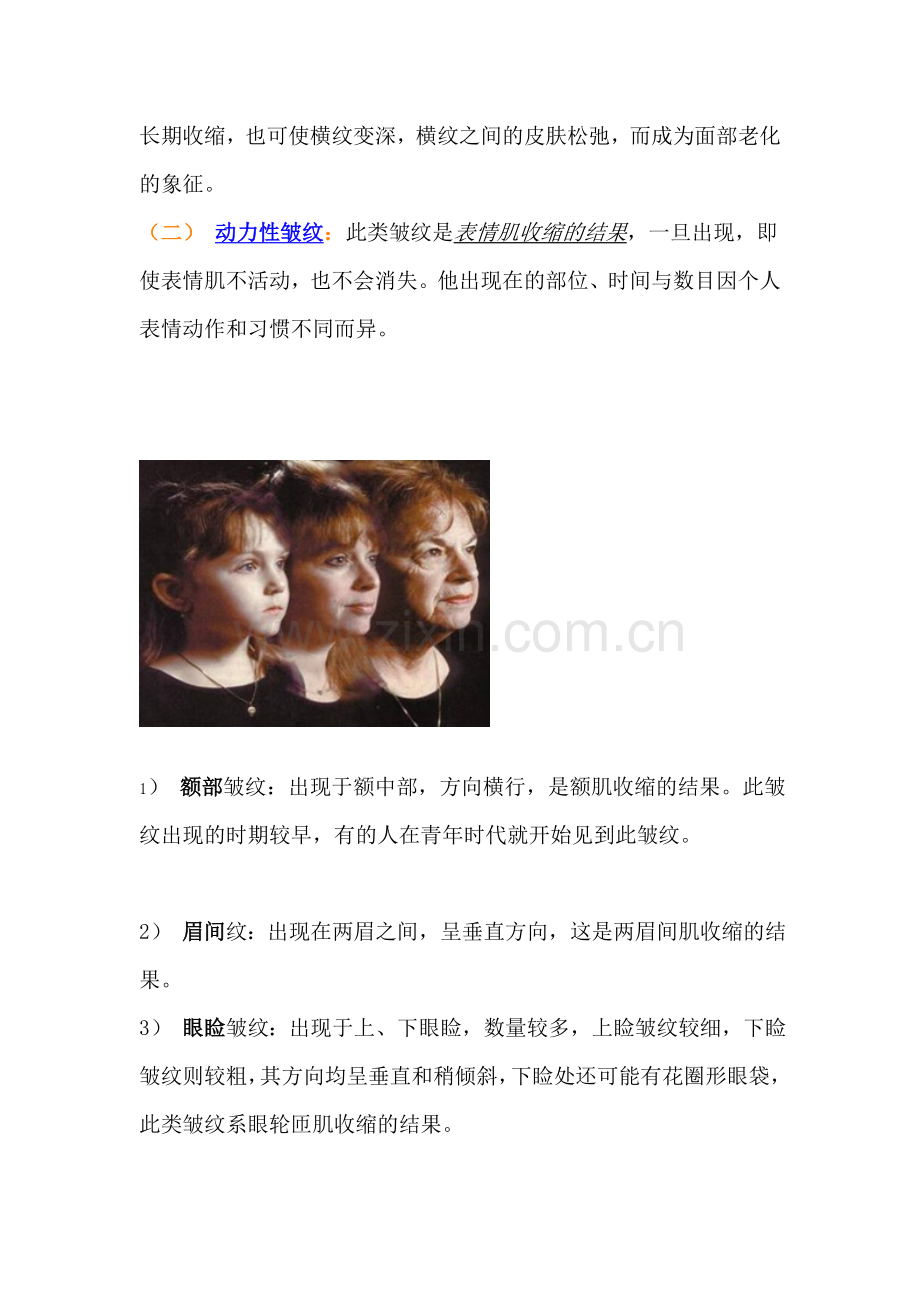 解读面部皱纹分类.doc_第2页