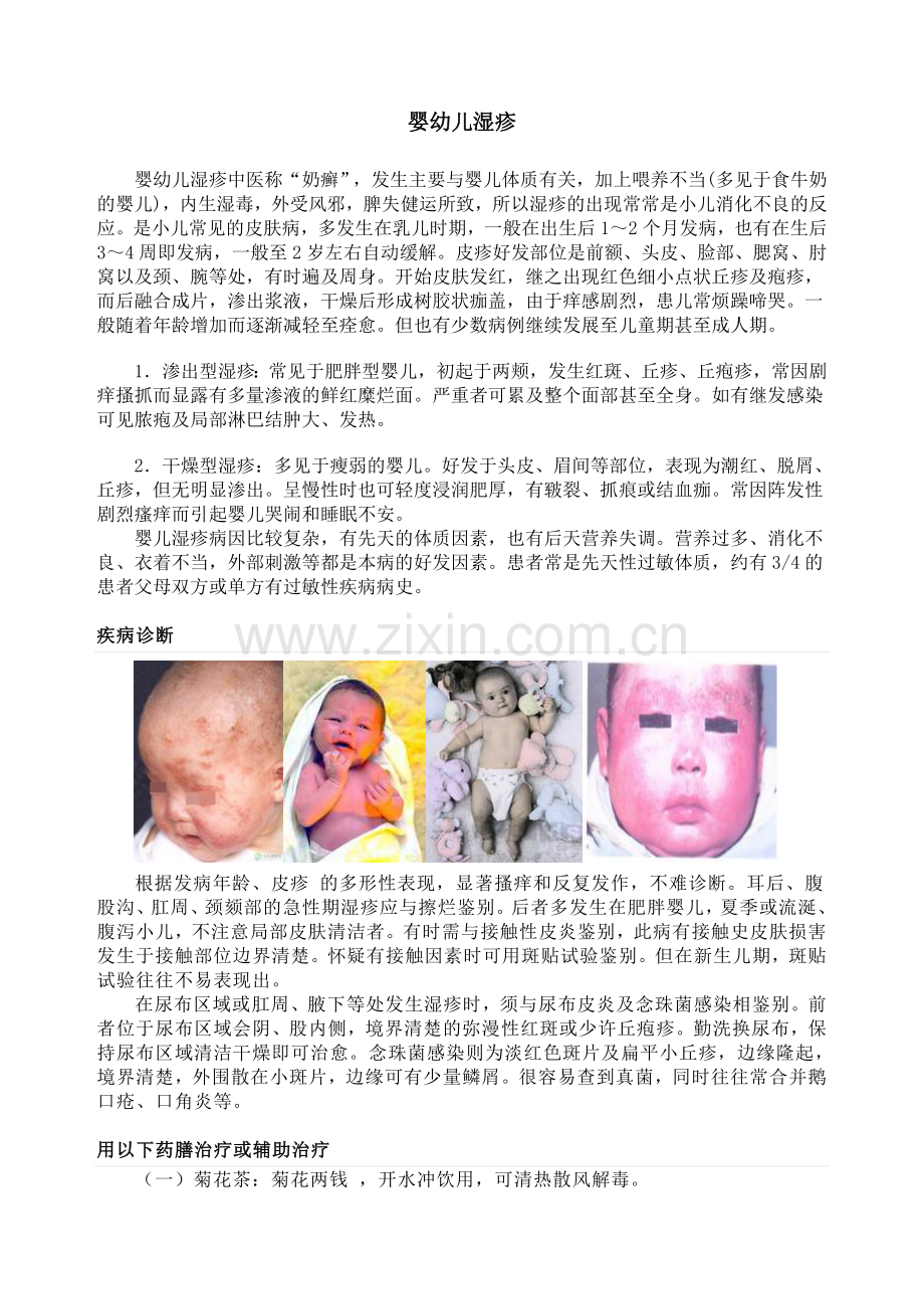 婴幼儿湿疹.doc_第1页