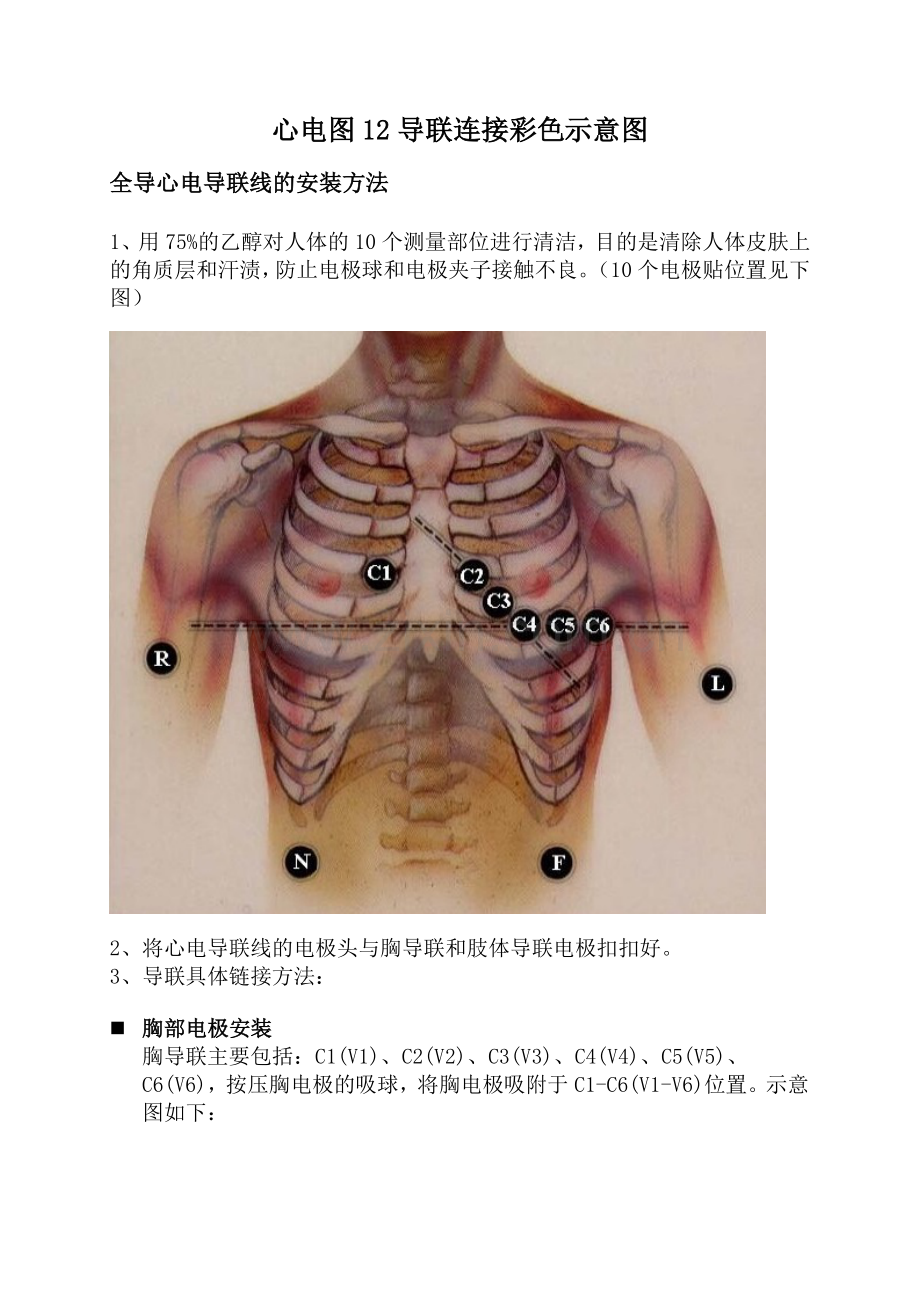 心电图12导联连接彩色示意图.doc_第1页