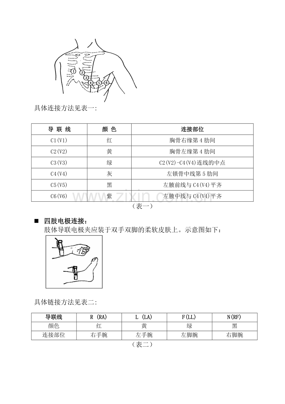心电图12导联连接彩色示意图.doc_第2页