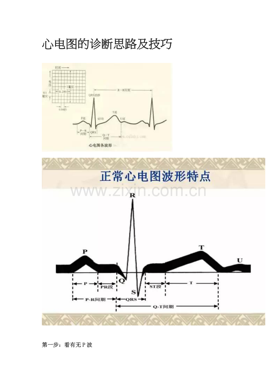 心电图的诊断思路及技巧.doc_第1页