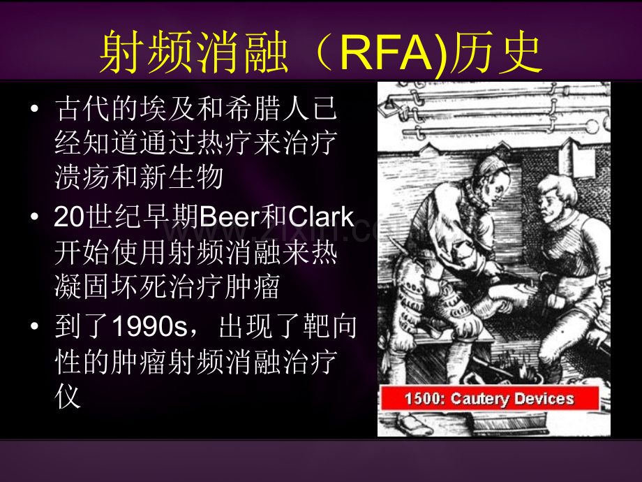 RITAX射频消融发生器.pptx_第1页