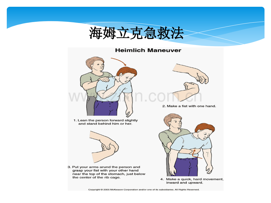 社区健康宣教.pptx_第2页