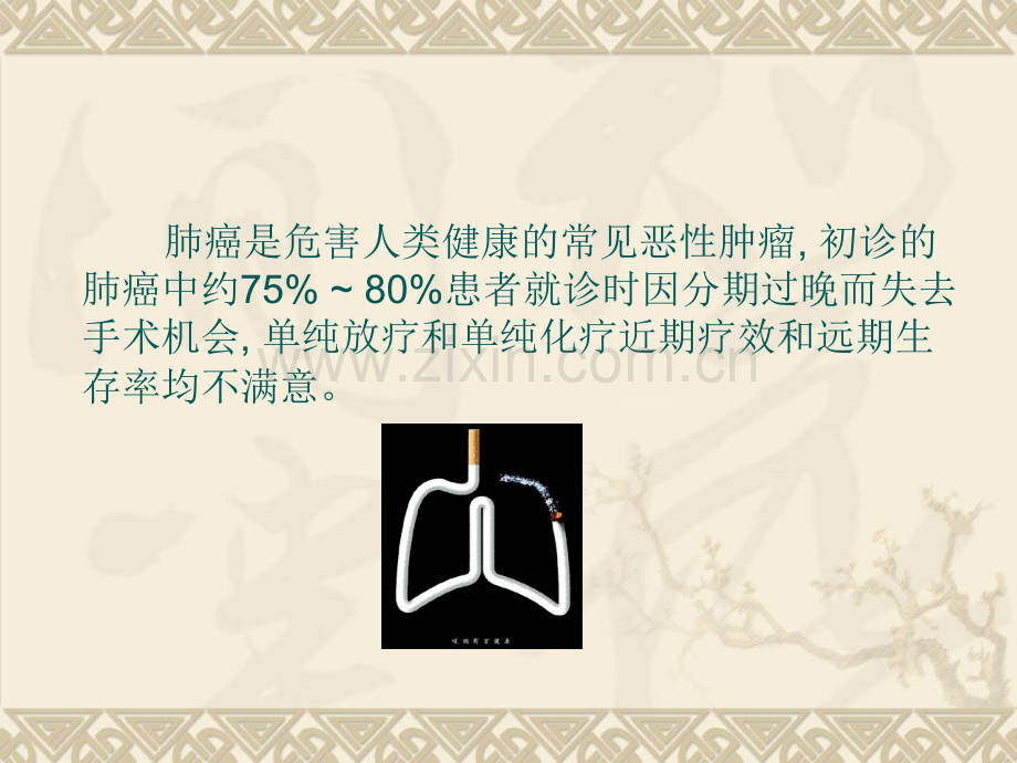 DL方案与DP方案同步放化疗.pptx_第2页