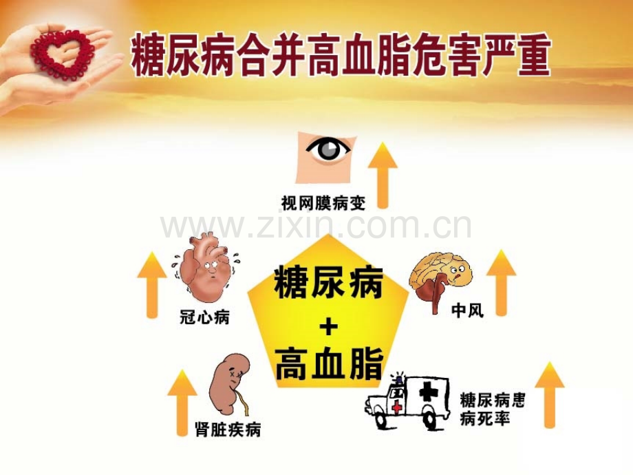 高血脂与糖尿病宣教.pptx_第2页