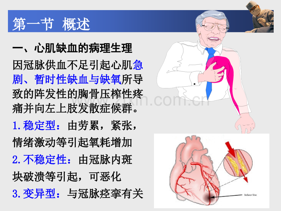 中职《药理学》课件第20章--抗心绞痛药.pptx_第2页