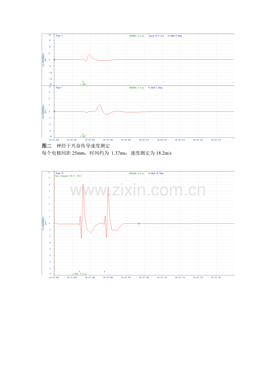 2023年神经干动作电位兴奋传导速度和不应期测定实验报告.doc_第2页
