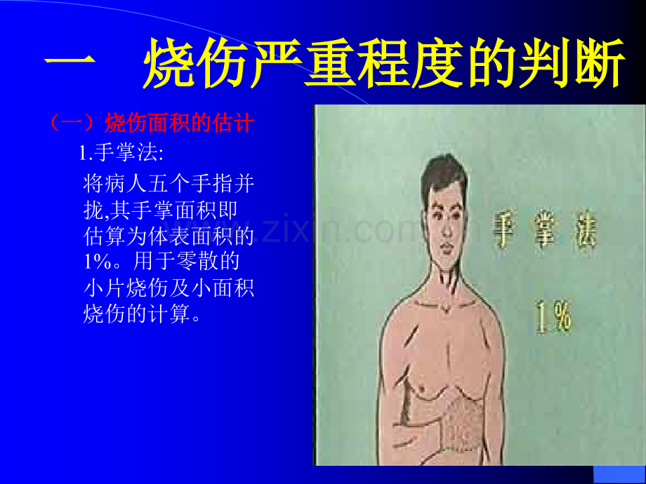 烧伤的现场急救.pptx_第2页