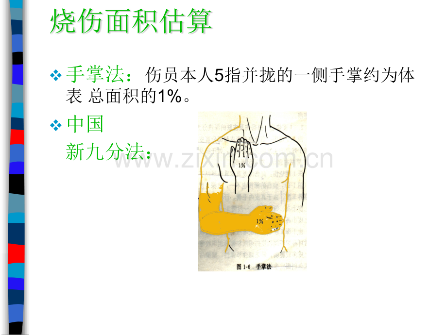 烧伤补液.pptx_第2页