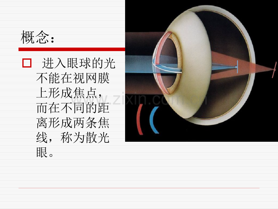 稍微深入讲述散光眼.pptx_第1页