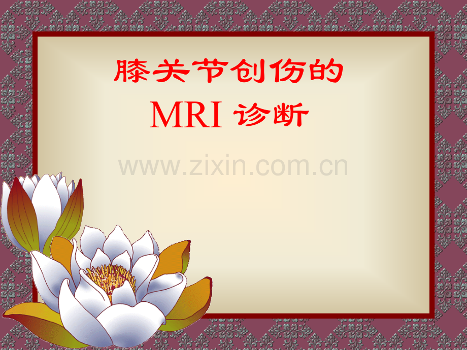 膝关节创伤的MRI诊断.pptx_第1页