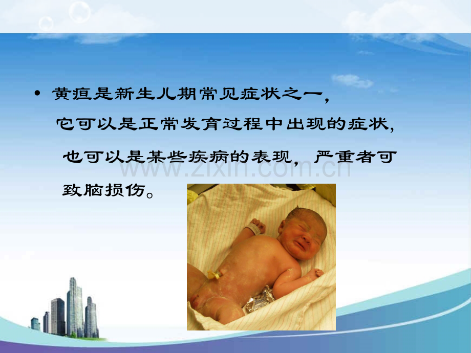 新生儿黄疸7月.pptx_第2页