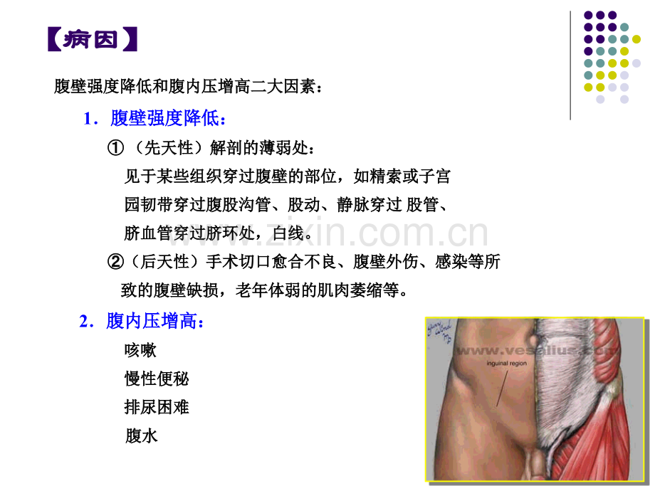腹外疝临床医学课件.pptx_第2页