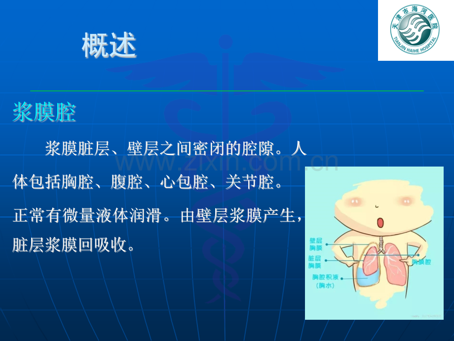 浆膜腔积液.pptx_第2页