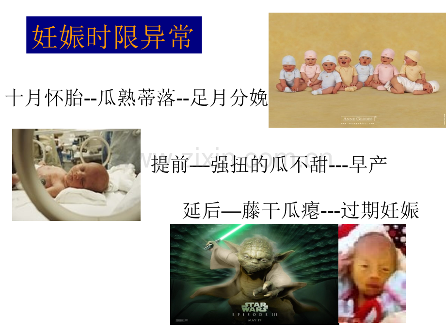 早产与胎膜早破.pptx_第1页