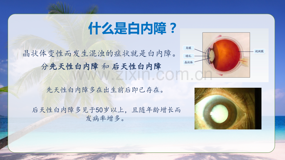 老年人常见眼病防治.pptx_第2页
