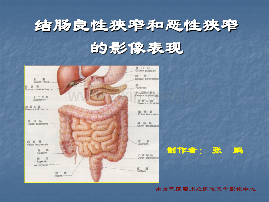 结肠良性狭窄和恶性狭窄影像表现.pptx_第1页