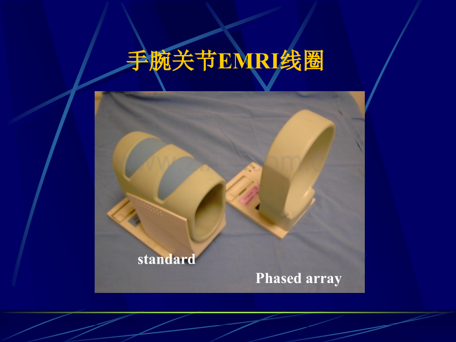 腕关节MRI影像诊断.pptx_第2页